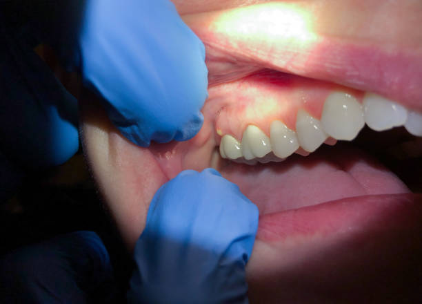 Best Walk-In Emergency Dentist in Puyallup, WA