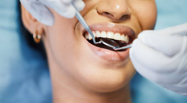 Best Emergency Treatment for Toothache in Puyallup, WA